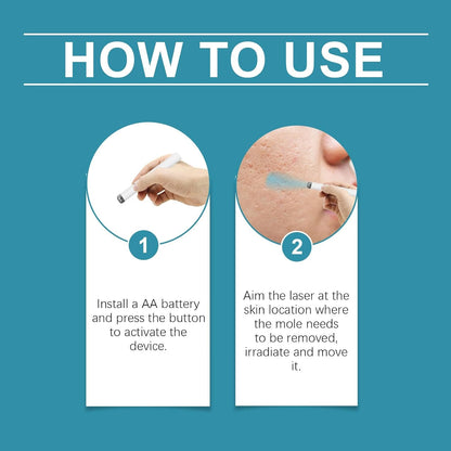 DermaClear™ Blue Laser Mole & Skin Tag Pen